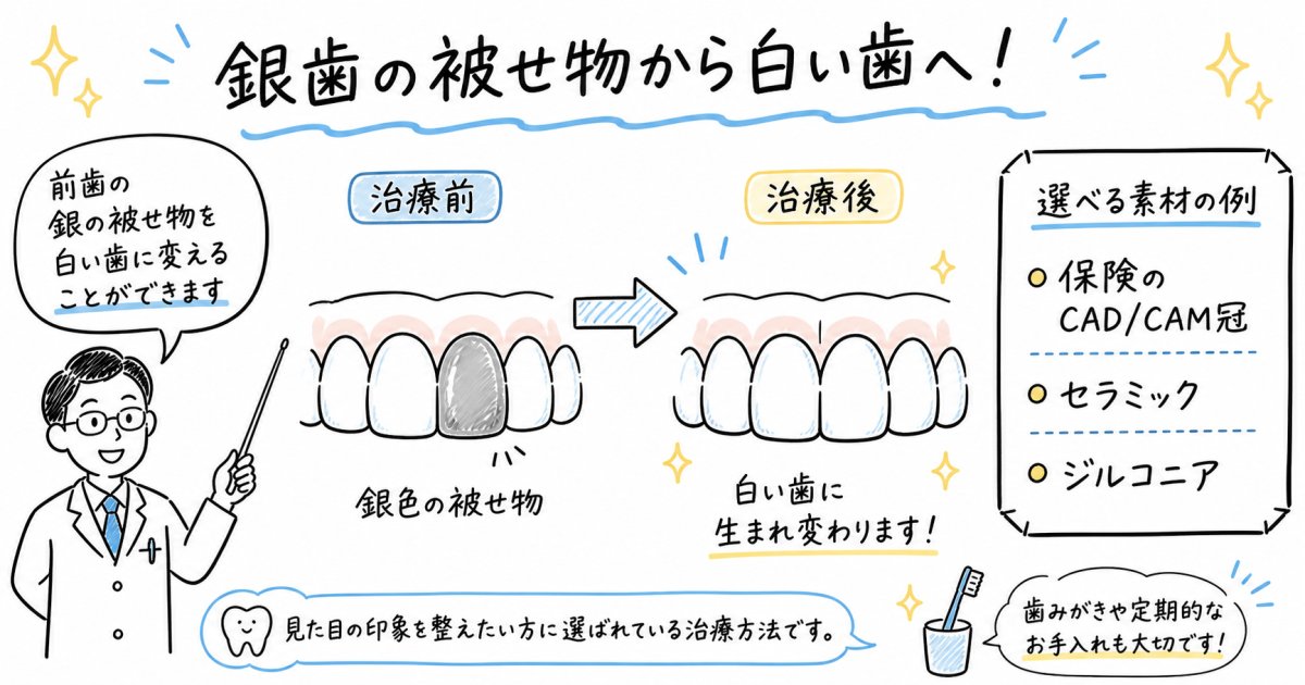 気になる前歯の銀歯を白く！治療法の種類や費用を歯科医が解説