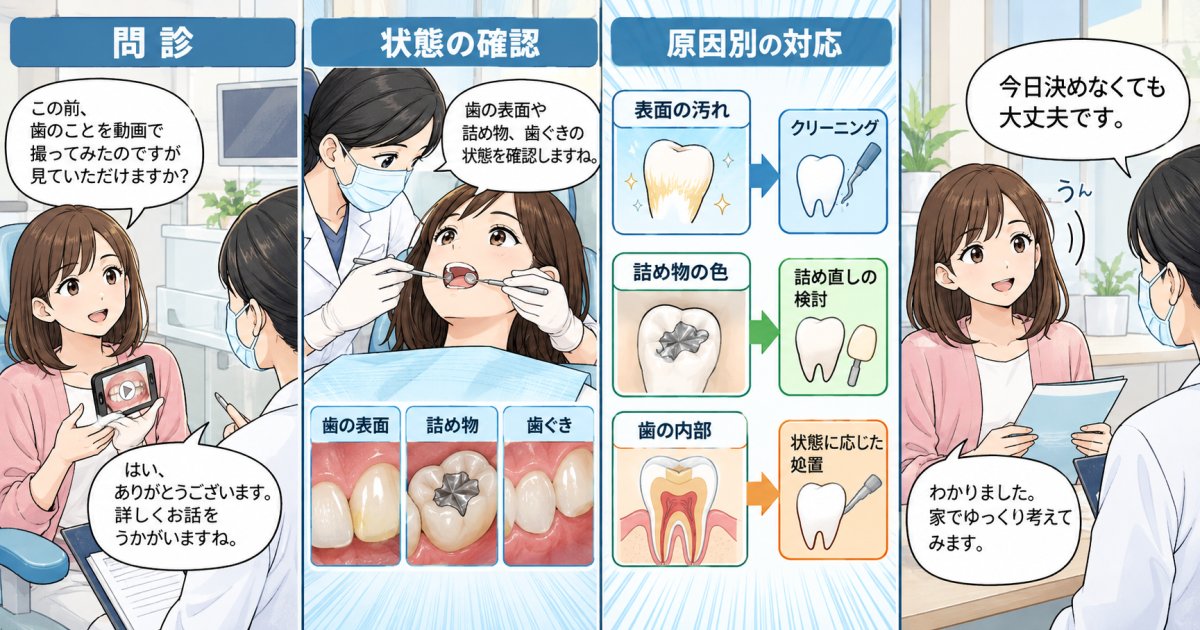 歯の色を相談した後、処置はどう決める?